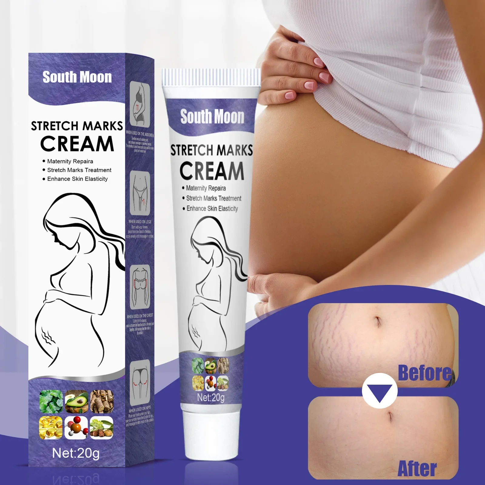 20G South Moon Stretch Marks Cream Fade Growth Lines Obesity Stretch Marks Postpartum Pregnancy Lines Mummy Cream Makeup Kit