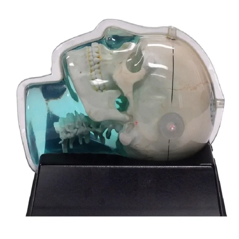 Nuclear magnetic distortion head detection motif