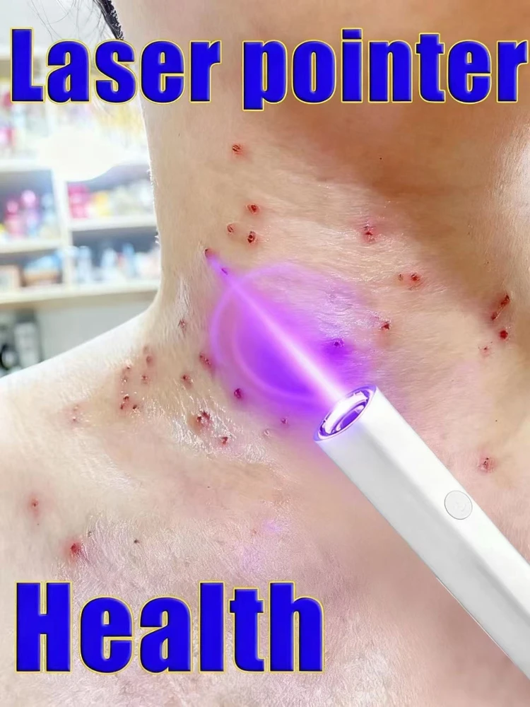 

Stylo Plasma Laser, outil de retrait d'étiquettes de peau.