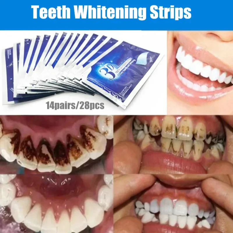 

Sdattor 28Pcs Teeth Whitening Strips Mint Scented Teeth Cleaning Gel Bleaching Tape Tooth Whitener Oral Care Dental Hygiene Brig