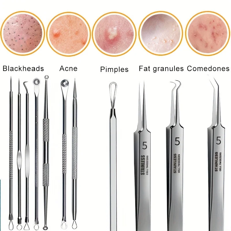 11pcs Stainless Steel Blackhead Remover Pimple Squeezer Tool Set Storage Box, Blackhead Remover Blemish Facial Skin Care Tools