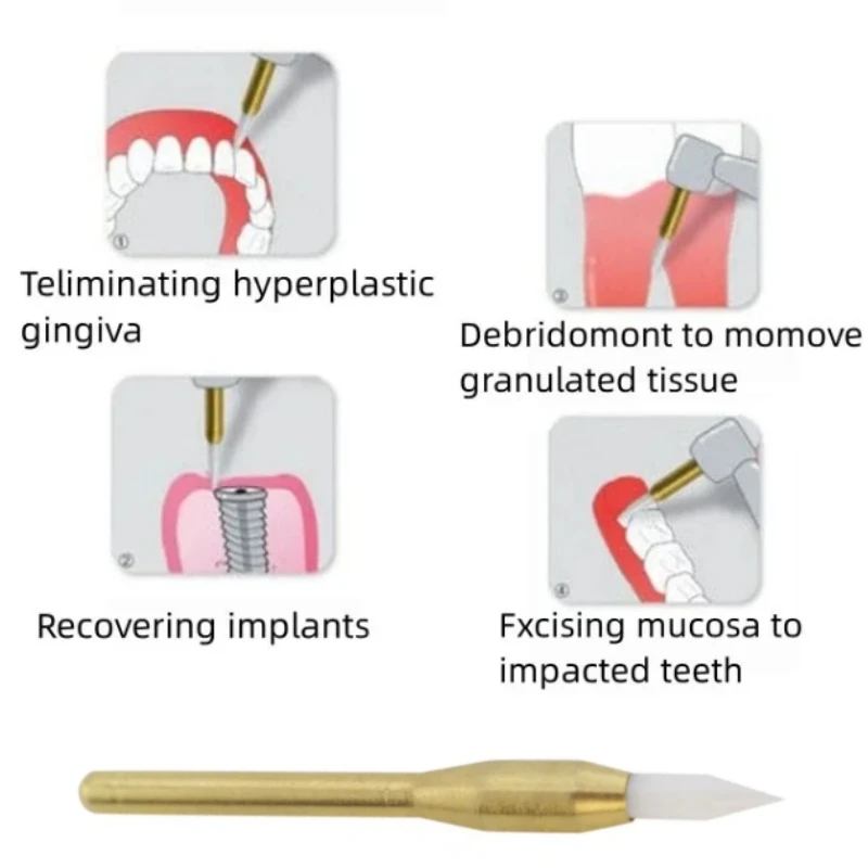 

2Pcs Dental Soft Tissue Trimming Burs Implant Surgical Ceramic Trimmer Tool for Gingiva Retraction Teeth Cleaning Whitening