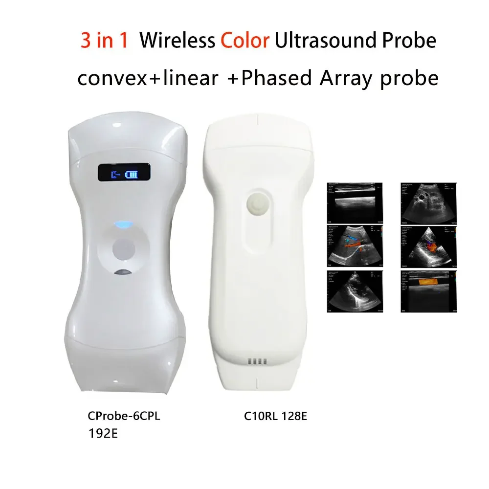 3 in 1 192E 128E Wireless Color Ultrasound Probe Scanner Portable Liner Convex Double Head Bluetooth Wifi-scanner