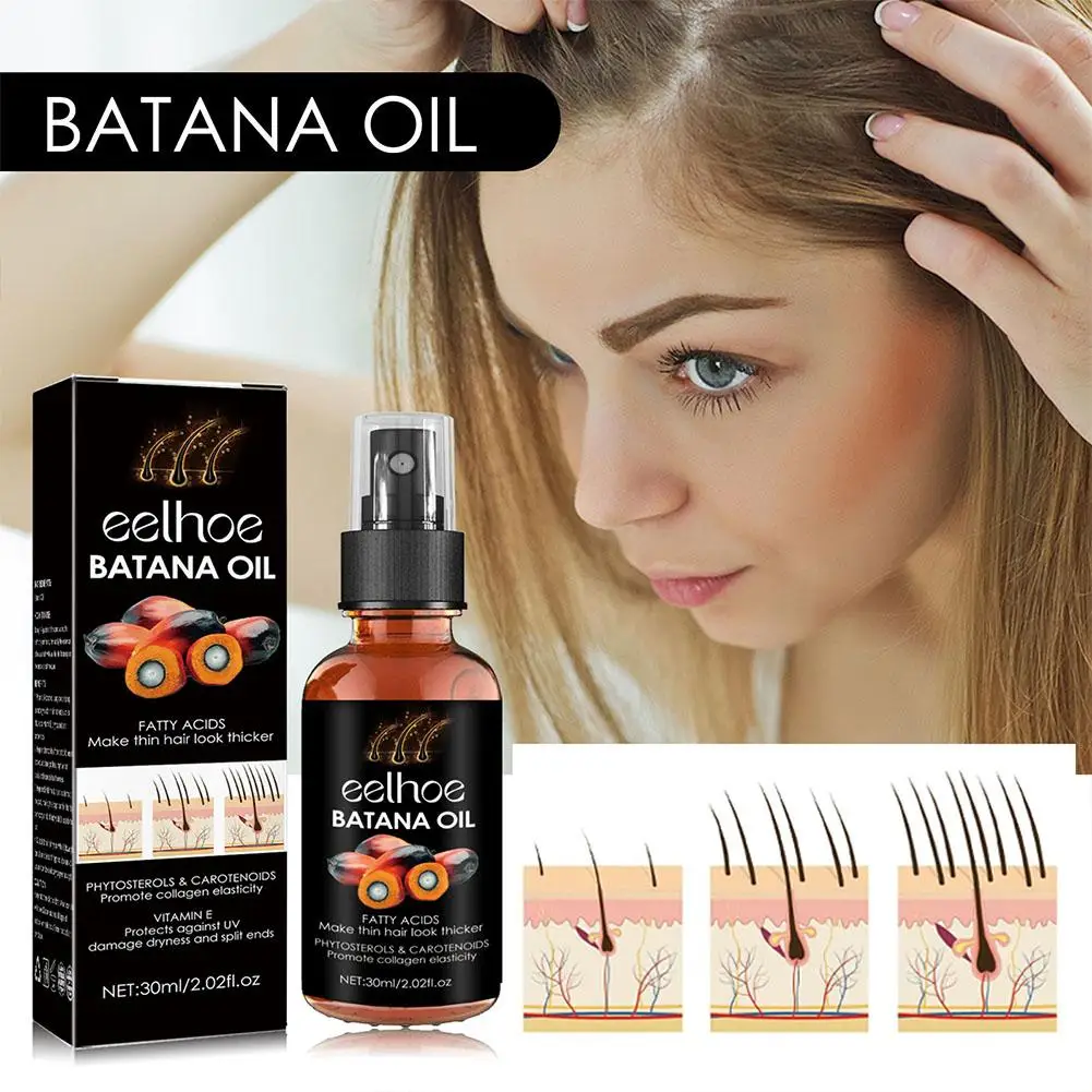 Batana Oil Hair Growing Spray Products Hair Loss Treatment Oil Fast Care for Men Women Beauty Health Care 30ml