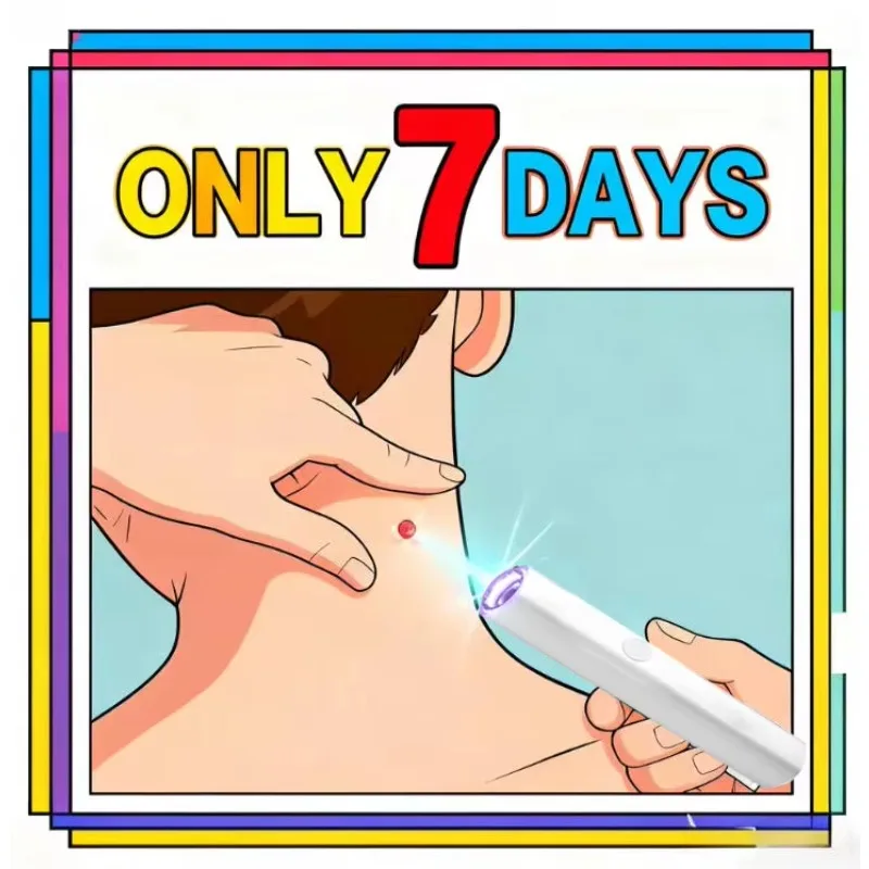 

2nd ᵍᵉⁿᵉʳᵃᵗⁱᵒⁿ ᵘᵖᵍʳᵃᵈᵉᵈ wᵃʳᵗ ⸴ ᑫᵘⁱᶜᵏˡʸ， ʳᵉpᵃⁱʳ wᵃʳᵗˢ ʳᵒoᵗ