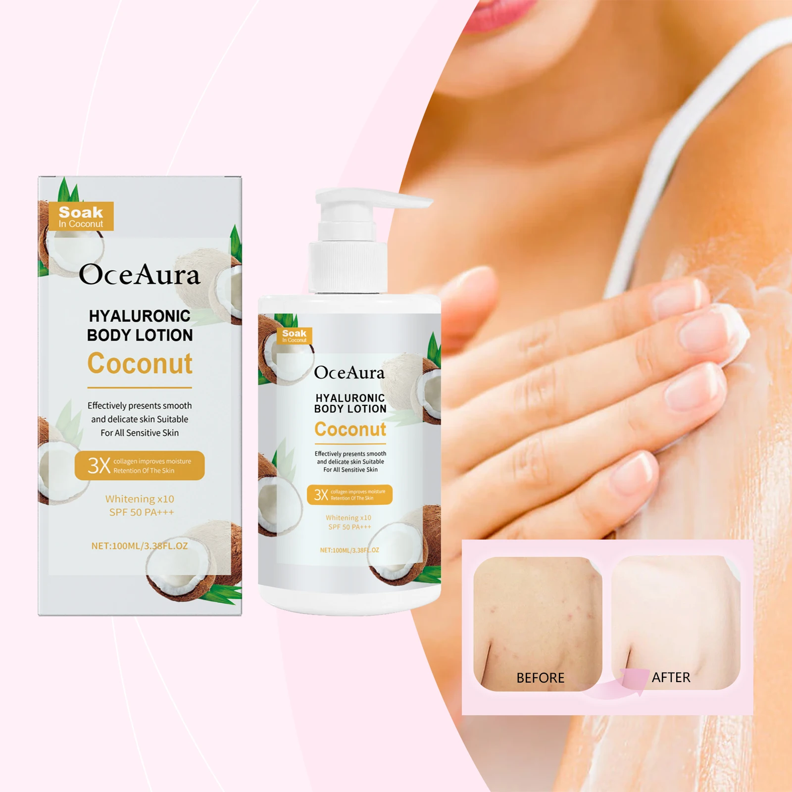 코코넛 히알루론산 바디 로션 - SPF 50 PA+++ 민감성 피부를 위한 화이트닝 & 하이드레이팅 모이스처라이저, 3X 스무딩 효과, 100ml/3