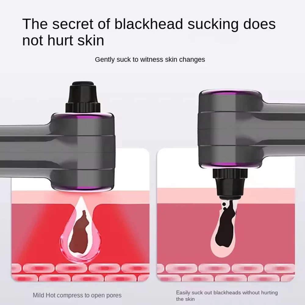 新しい電気にきび除去家庭用毛穴クリーナー美容器具にきび除去クレンザー