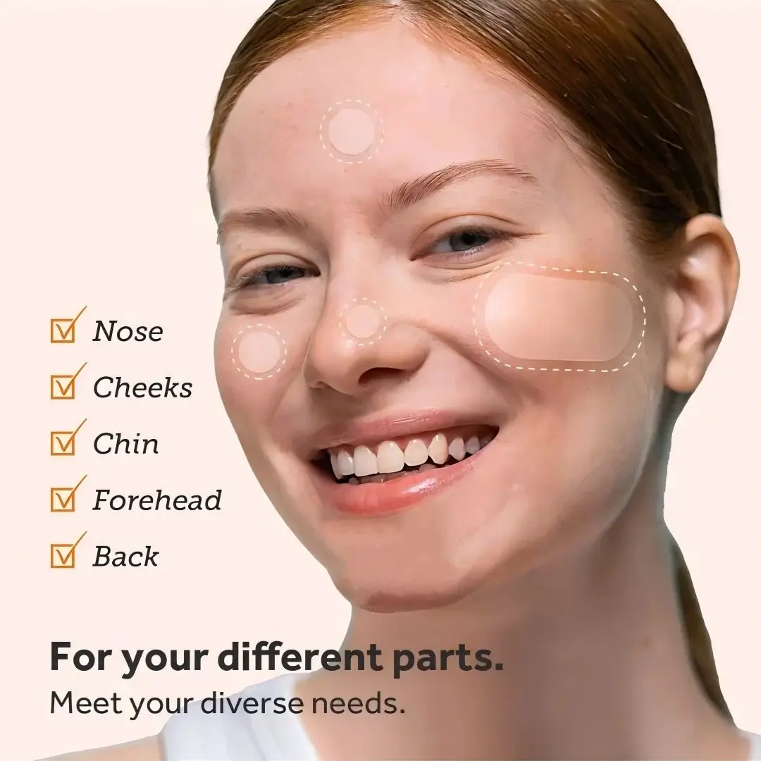 Parche para eliminar el acné de hidrogel (2 formas), 190/380 unids/caja, parche para eliminar el acné de limpieza profunda, parche eficaz para eliminar el acné