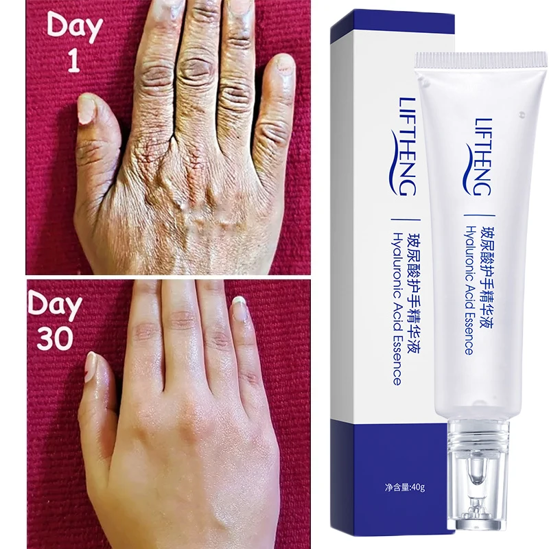 Wrinkle Removal Anti-Crack Hand Cream Hyaluronic Acid Fast Whitening Soften Nourish Anti-drying Whitening Moisturizing Hand Care