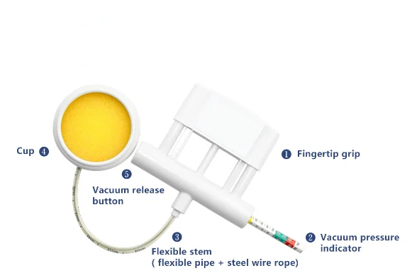 

New Obstetric Auxiliary Suction Cup Labor Helper Disposable Fetal Head Vacuum Delivery System