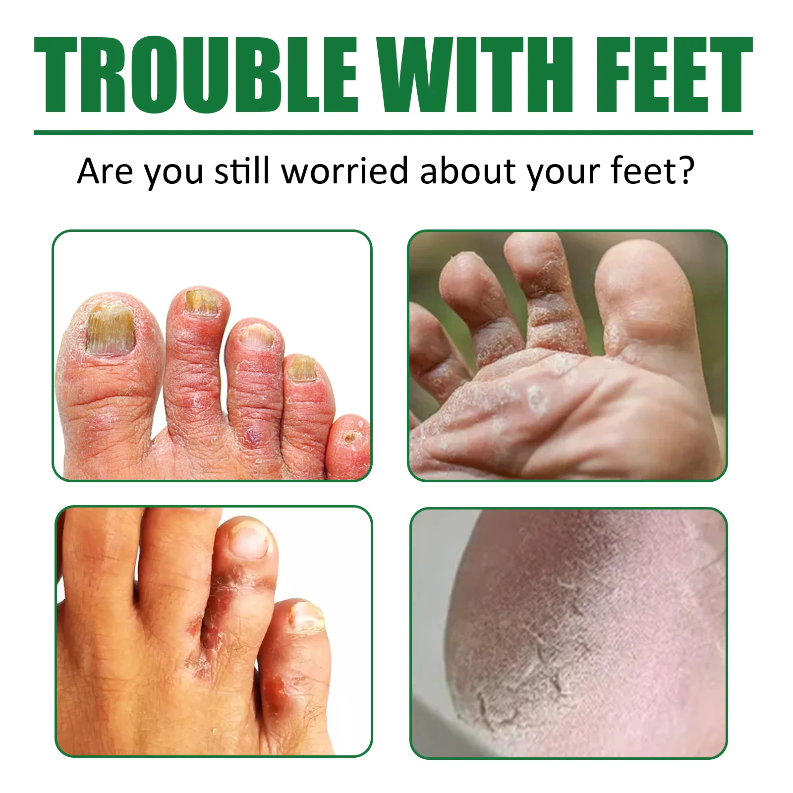 

Anti Wear Foot Cream Exfoliate Remove Dead Skin Callus Improve Rough Repair Dry Cracked Heel Moisturizing Feet Skin Care Lotion