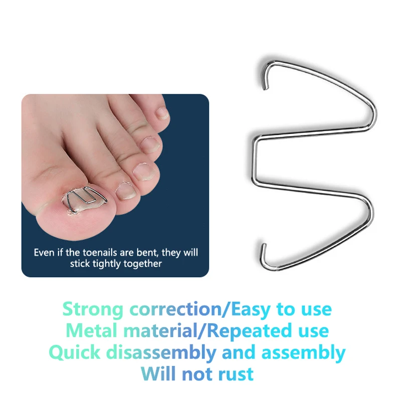 Ingrown Toenail Correction Tool Ingrown Toe Nail Treatment Nail Hook/Steel Wire Straightening Clip Paronychia Pedicure Corrector