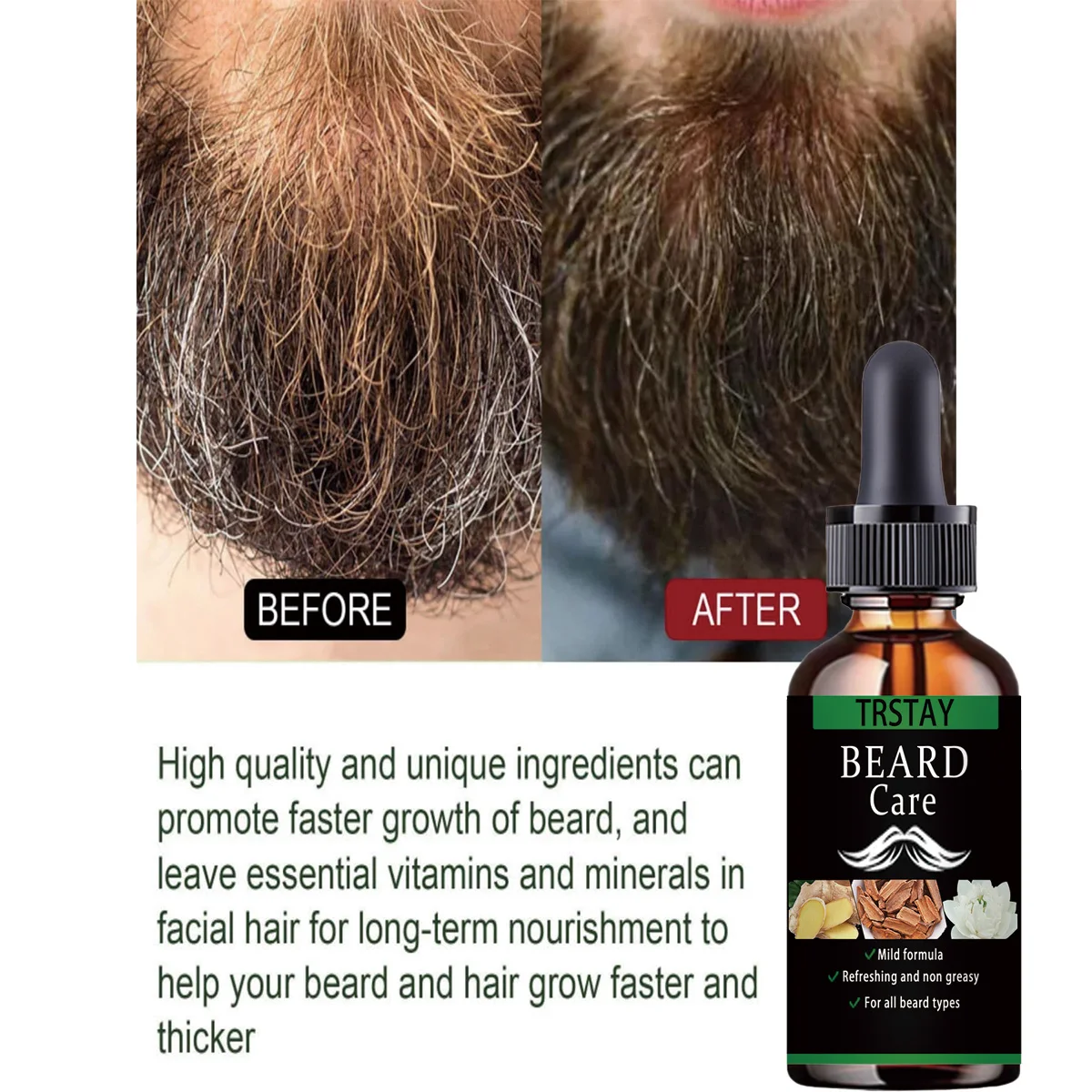 새로운 수염 모발 성장 에센셜 오일 탈모 제품, 천연 콧수염 재성장 오일, 남성 영양 수염 케어 롤러