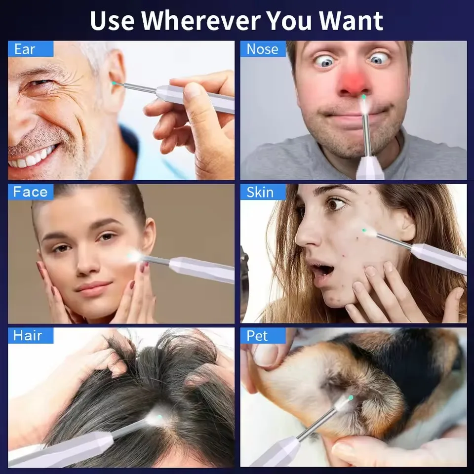 منظار الأذن عالي الدقة مع مجموعة أدوات إزالة شمع الأذن للكاميرا مع 6 أضواء LED للهواتف الذكية iPhone iPad Android