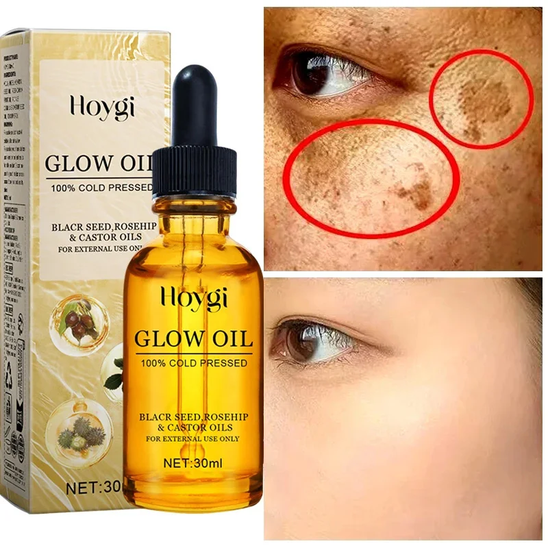 

Effective Whitening Freckle Essence Remove Dark Spot Lotion Removal Melanin Melasma Lighten Brighten Anti-Aging Skin Care 30ml