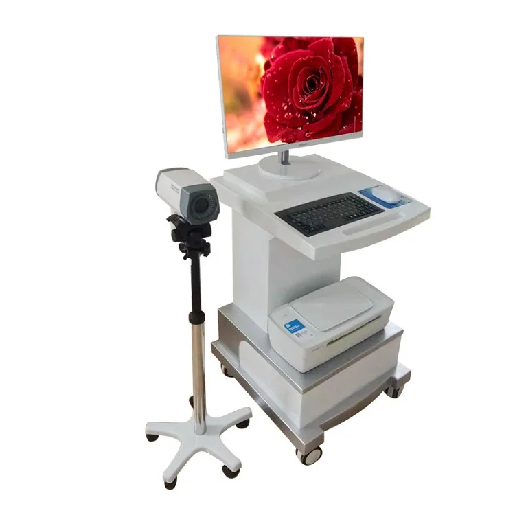 Electronic Colposcopy Sony High Definition Gynecological External Probe Endoscopy Cervical Instrument Medical Yikokang