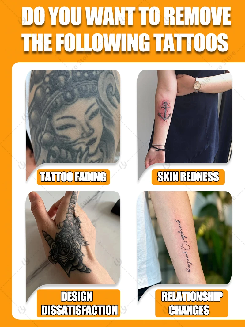 Fade stubborn tattoos effective in removing permanent tattoos