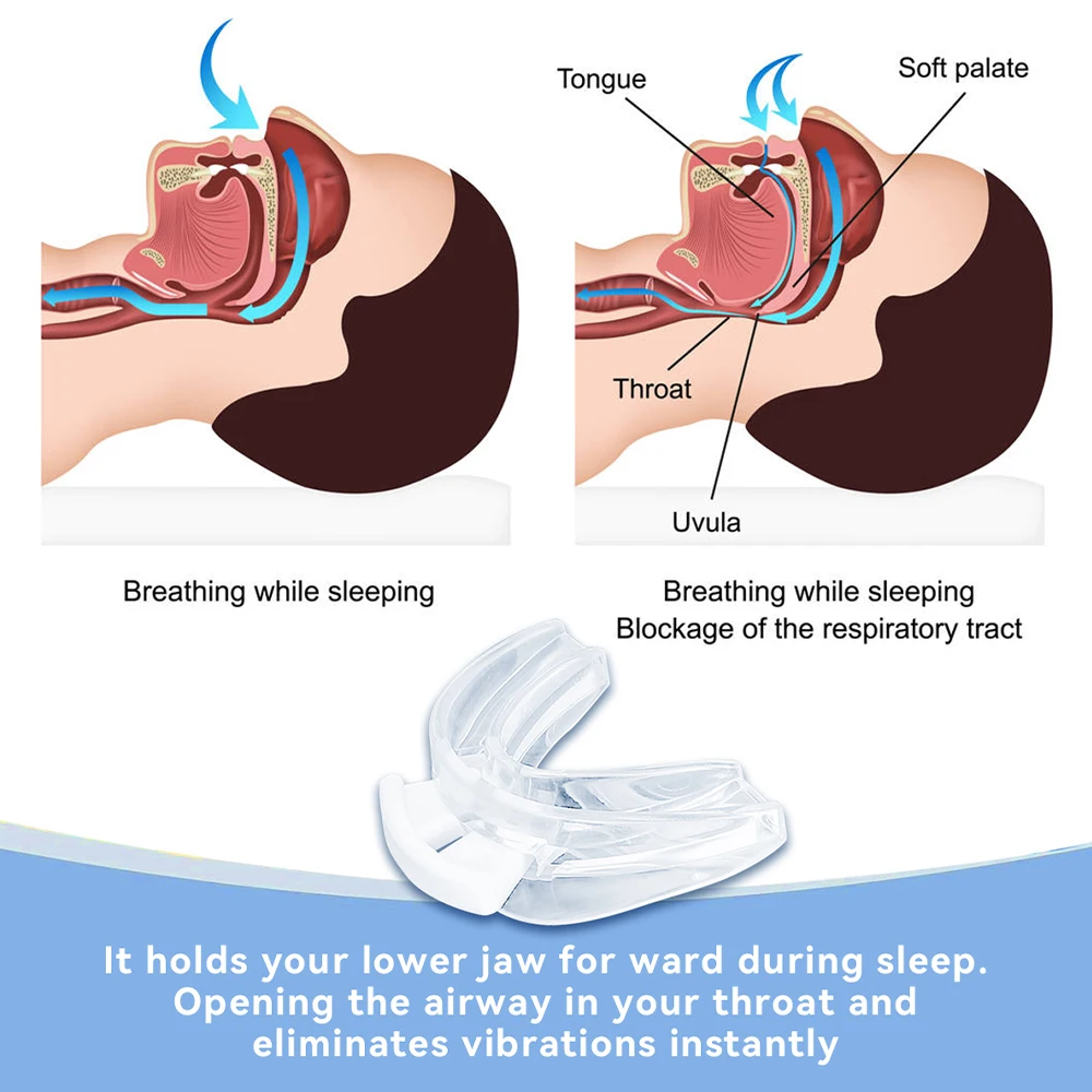New Anti Snoring Tooth Brace Mouth Guard Adjustable Anti-Snoring Mouthpiece Easy Breathe Teeth Bruxism for Night Better Sleeping