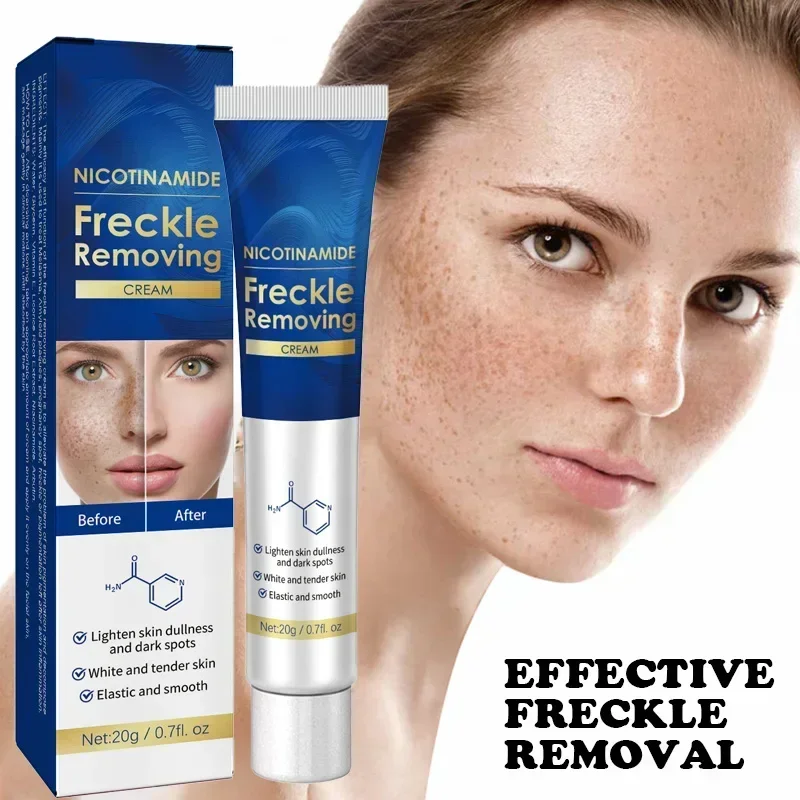 Dark Spot Remover for Face Removing Freckle Chloasma Senile Plaques Sunburn Cyasma Chorioplaque Freckle Cream