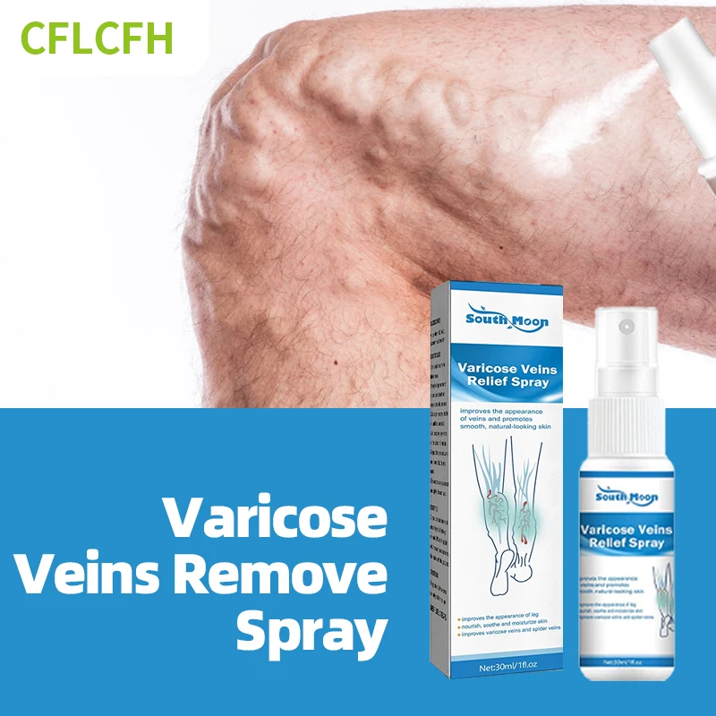 

Varicose Veins Treatment Spray Spider Leg Angiitis Legs Dilated Relief for Varicosity Vasculitis Phlebitis Foot Care Medicine