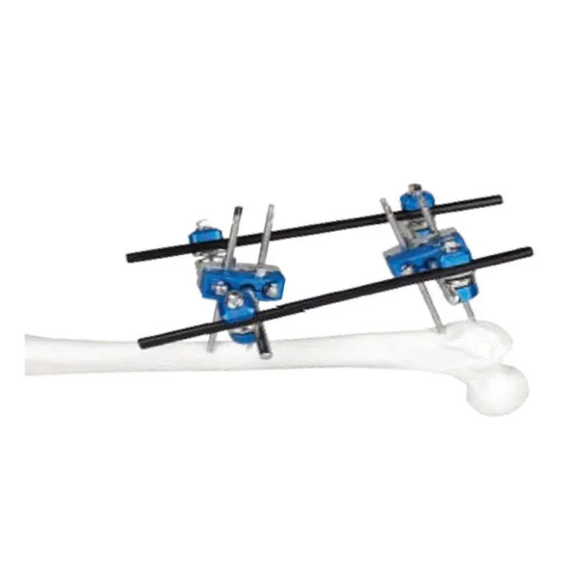 Fijador de medio anillo para implante ortopédico