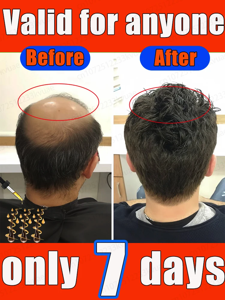 

Effectively solve the problem of hair loss! Popular online selling genuine product, suitable for all people with hair loss!。