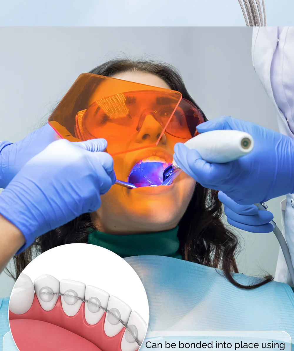 10 Teile/paket AZDENT Dental Kieferorthopädische Lingual Retainer Drähte Flache Gerade Twist Drähte Edelstahl 15 cm Zahnmedizin Materialien – Detail 6