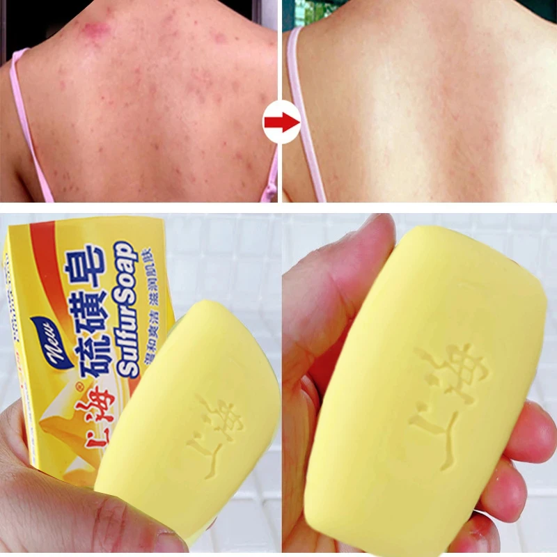 10Pcs original Shang Hai LiuHuang soap 125g/pcs