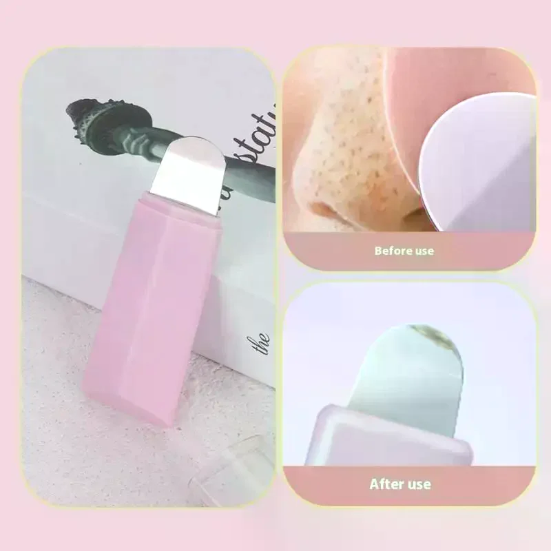 2 قطعة مزيل الرؤوس السوداء الجلد الغسيل ملعقة بثرة حب الشباب إبرة أداة الوجه المسام الأنظف مجموعة العناية بالبشرة #3