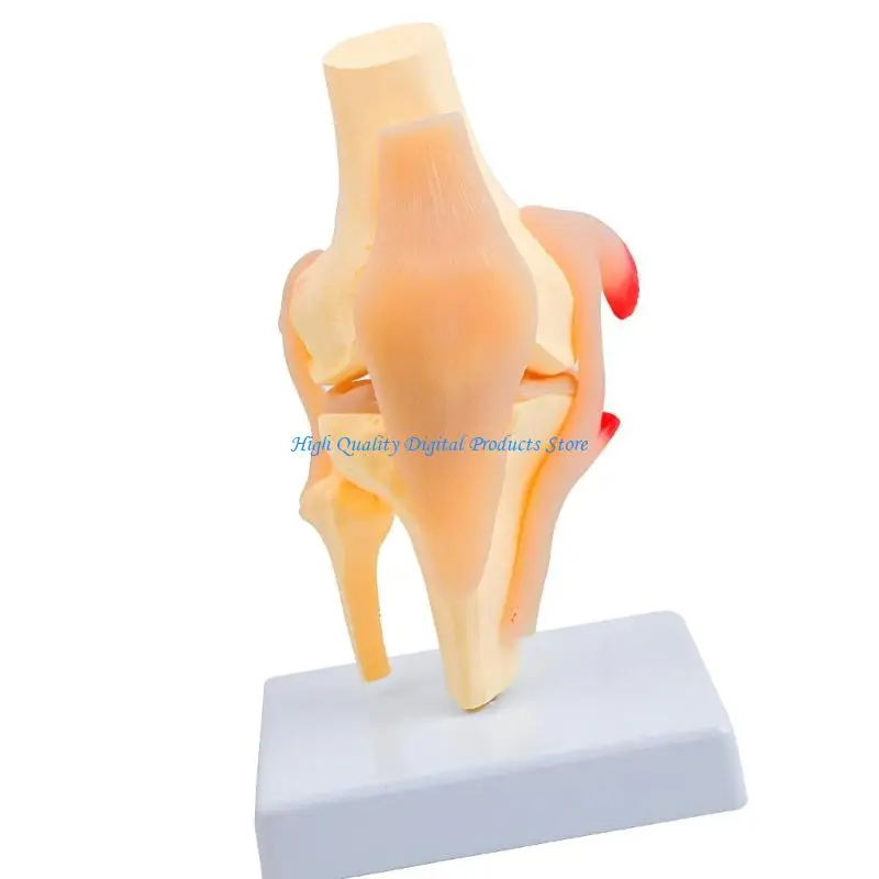 U2JE Anatomical Patella Knee Joint Model With Detailed Muscles Ligaments For Clinical Training and Classroom Demonstration