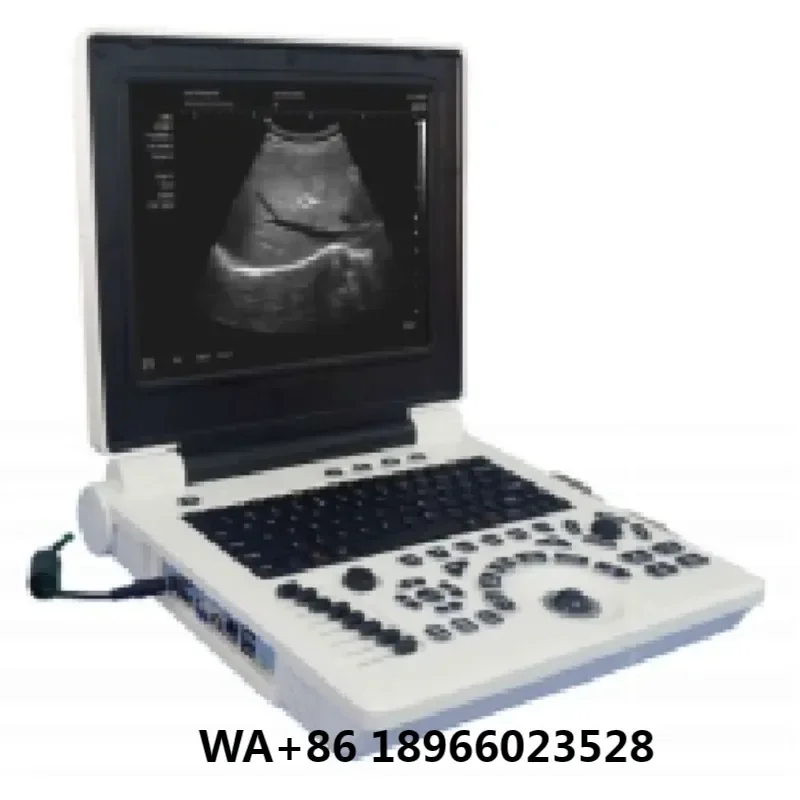 Portable  Scanner Machine For Hospital Full Digital LED Professional Diagnostic Ultrasound System Black and White