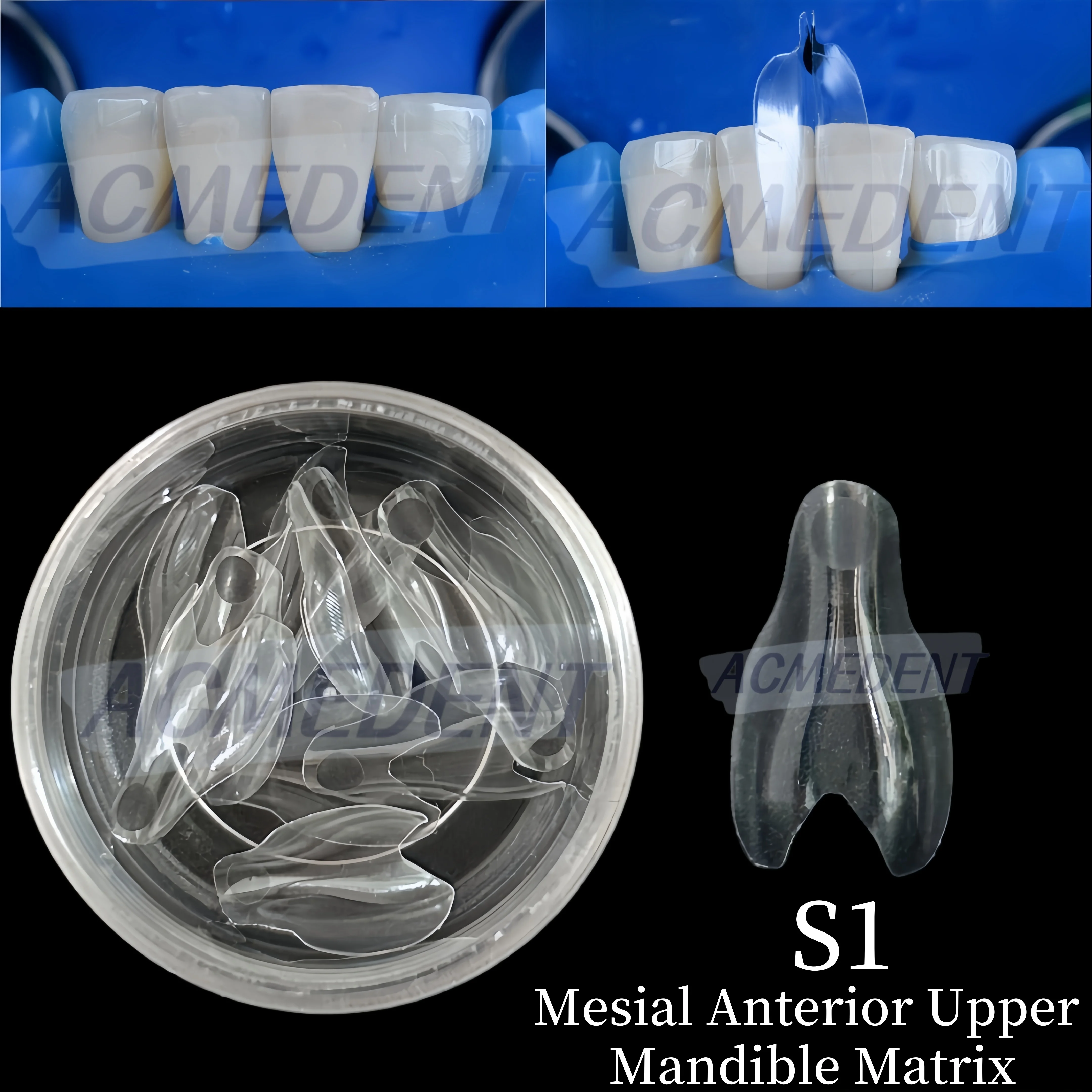 S1 Dental Transparent Matrix Clear Matrix BT Bow Maxillary Matrices Contoured Similar with BioClear Matrice Black Triangle