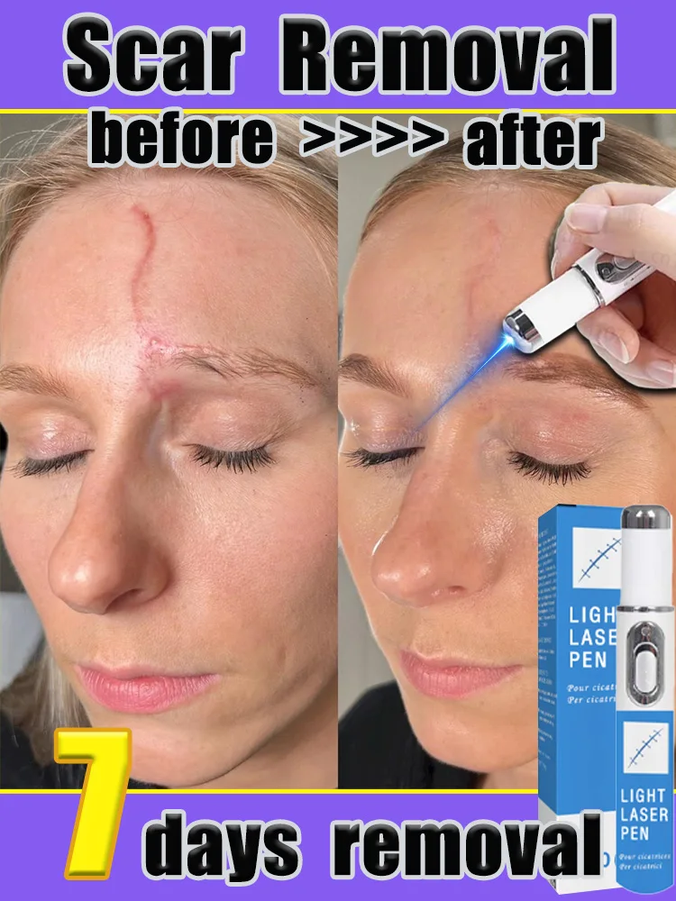 

Новейшая технология удаления шрамов, удаление шрамов за 7-днем.