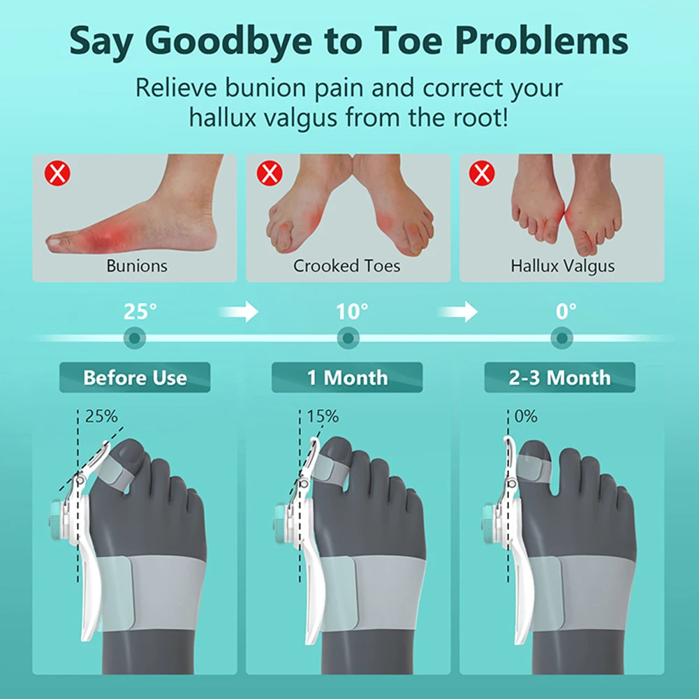 Uniseksowa prostownica do palców u stóp korektor łagodzi ból za pomocą pokrętła kciuk zapalenie stawów szyna obrotowa regulowana odzież na co dzień do artykułów stóp