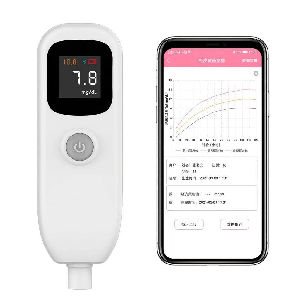 Handheld Neonatal Jaundice Meter Transcutaneous Bilirubinometer Bilirubin Jaundice Meter Detector