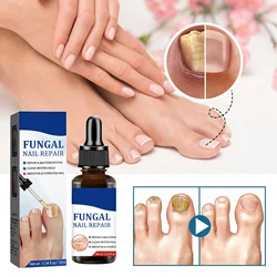 3Nail Fungals Renewal Nail Repair Liquid for Discolored Thickened Crumbled Nails Nail Fungals for Discolored Broken Cracked S5BS