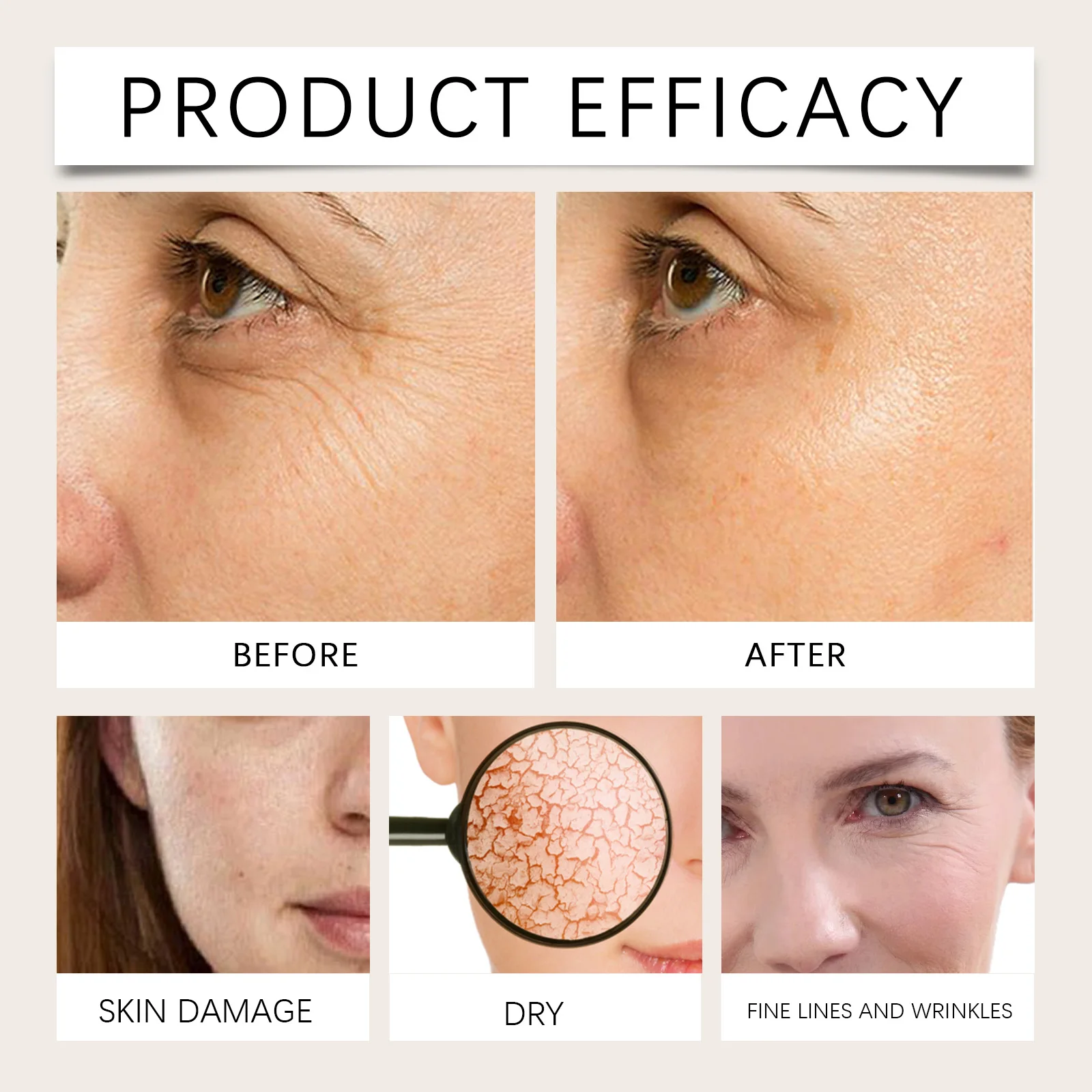 Bee Venom Moisturizing and Anti-wrinkle Skin Care Cream Removes Dark Spots Lightens Freckles Reduce Fine Lines Facial Cream - view 6