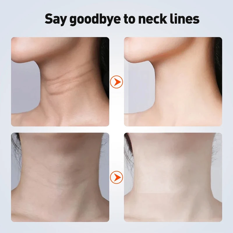 جهاز تجميل الرقبة المضغوط البارد والساخن للوجه EMS العلاج بالضوء بالألوان الحالية الصغيرة لتعزيز جهاز تدليك الذقن والرقبة