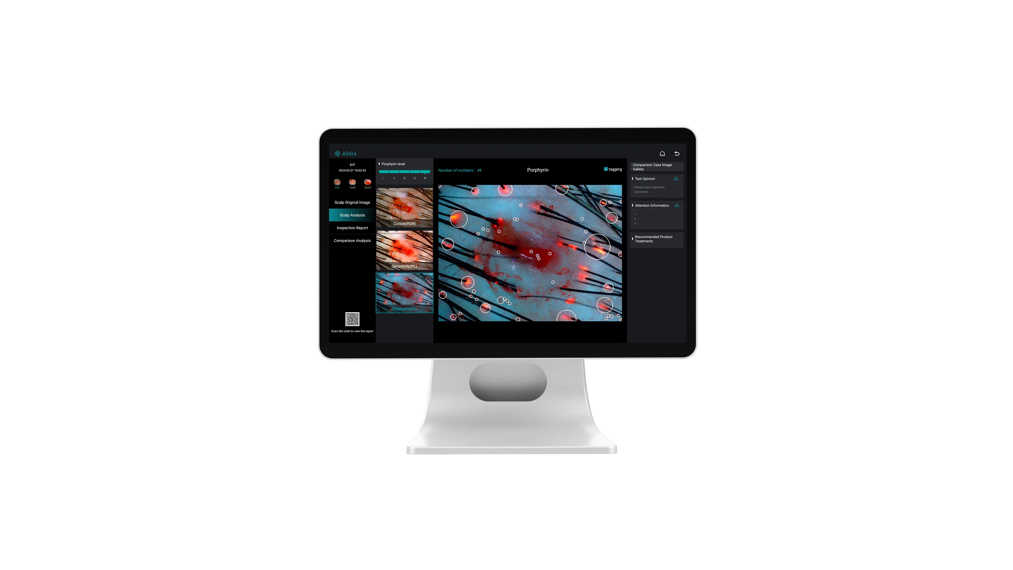 16 مليون كشف عالي الوضوح HD آلة تحليل الشعر وفروة الرأس العناية بالشعر كاشف بصيلات الجلد محلل فروة الرأس اللاسلكي