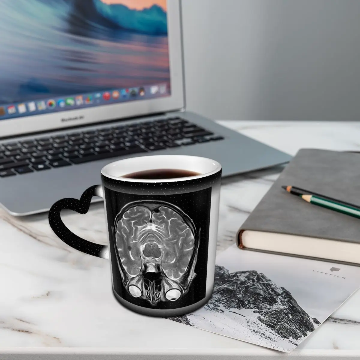 كوب MRI Of The Brain، أكواب قهوة سيراميك مضحكة، أكواب شاي، كوب حليب، أدوات للشرب هدية للأصدقاء