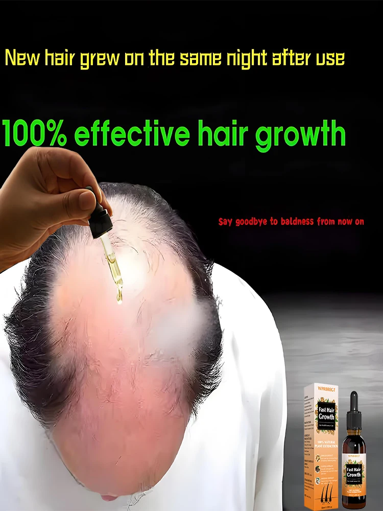 

Hᴀɪʀ ɢʀᴏᴡᴛʜ ᴀɴᴅ ʀᴇɢᴇɴᴇʀᴀᴛɪᴏɴ ᴄᴀʀᴇ, sᴛʀᴏɴɢ ᴀɴᴅ ɴᴏᴜʀɪsʜɪɴɢ ʜᴀɪʀ, ʟɪɢʜᴛᴡᴇɪɢʜᴛ ᴀɴᴅ ɴᴏɴ ɢʀᴇᴀsʏ sᴄᴀʟᴘ, ɪᴍᴘʀᴏᴠɪɴɢ sᴄᴀʟᴘ ᴄɪʀᴄᴜʟᴀᴛɪᴏɴ