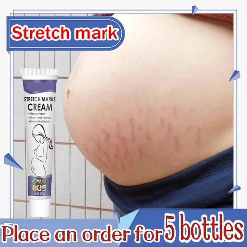 

Pregnancy Repair Stretch Mark Removal Acne Scar Maternity Stretch Marks Remove Fat Striae Scars Treatment skin Care