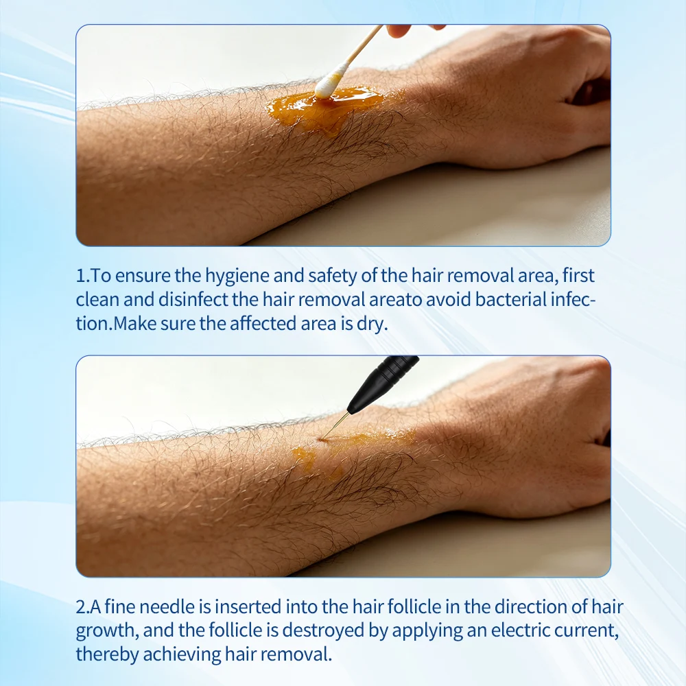 Electrolysis Hair Removal Machine Facial Epilator Permanent Hair Removal for Men Women Body Bikini All Hair Colors Remove