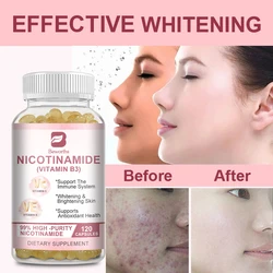 BEWORTHS Nicotinamide Capsule NAD Whitening Antioxidant Brightens Skin Tone Repairs Skin Baby Muscle Freckle Removal