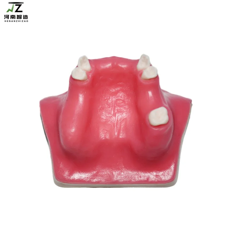 

Модель зубного имплантата, имитирующая стоматологическая модель, максимальное синус, повышение C