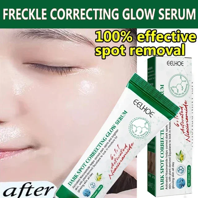 كريم تفتيح الكلف نياسيناميد ، تقليل كريم تفتيح الميلانين ، تفتيح البشرة الداكنة ، سيروم الكلف ، تلاشي خطوط الوجه الدقيقة #1