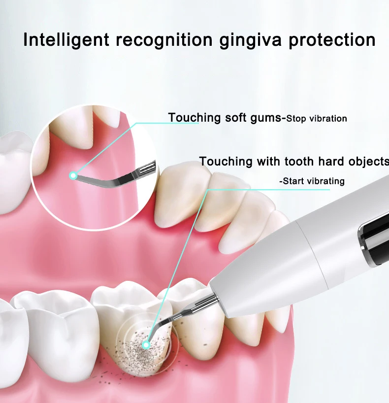 الكهربائية سونيك الأسنان حساب التفاضل والتكامل مزيل قشارة بالموجات فوق الصوتية الأسنان الجير مزيل البلاك البقع إزالة طقم تنظيف الأسنان المنزلية