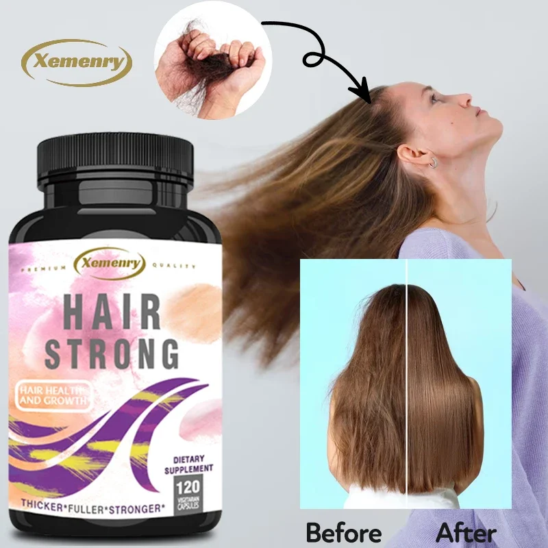 

Xemenry Hair-strengthening Growth Vitamins with Biotin, Keratin and Collagen for Thicker, Fuller, Healthier Hair, Skin and Nails