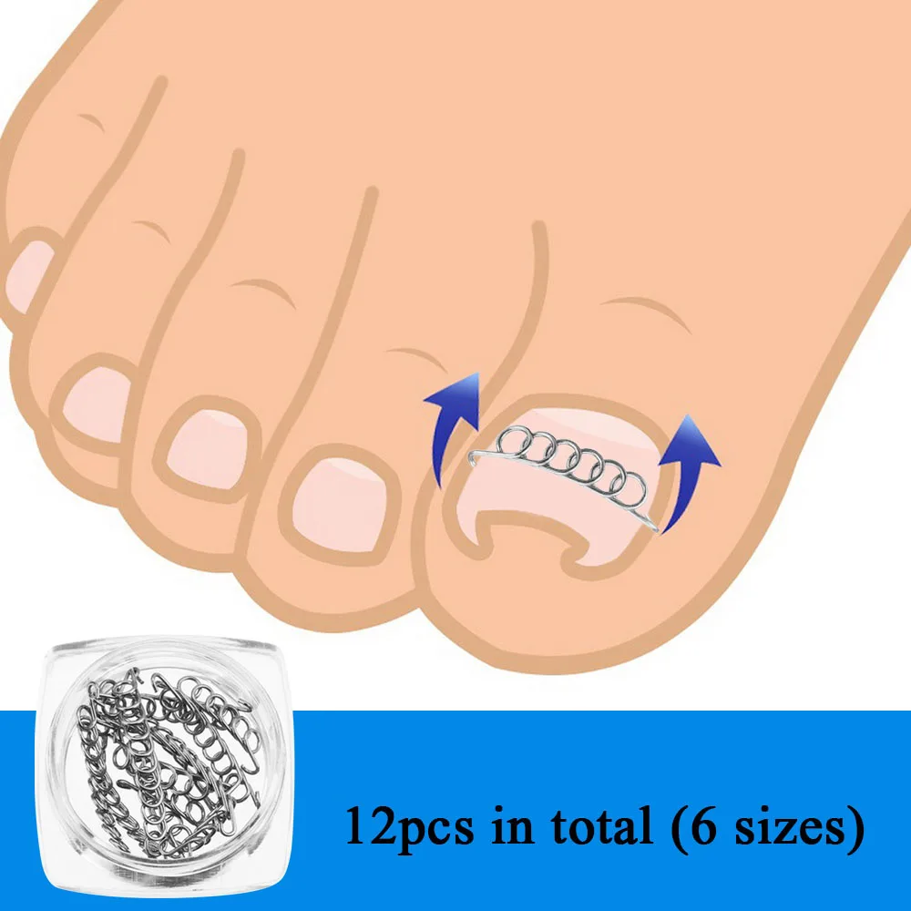/صندوق نام أظافر تصحيح سلك المثبت 6 أحجام نام تو مصحح باديكير علاج العناية بالقدم أداة العناية بالقدم أداة