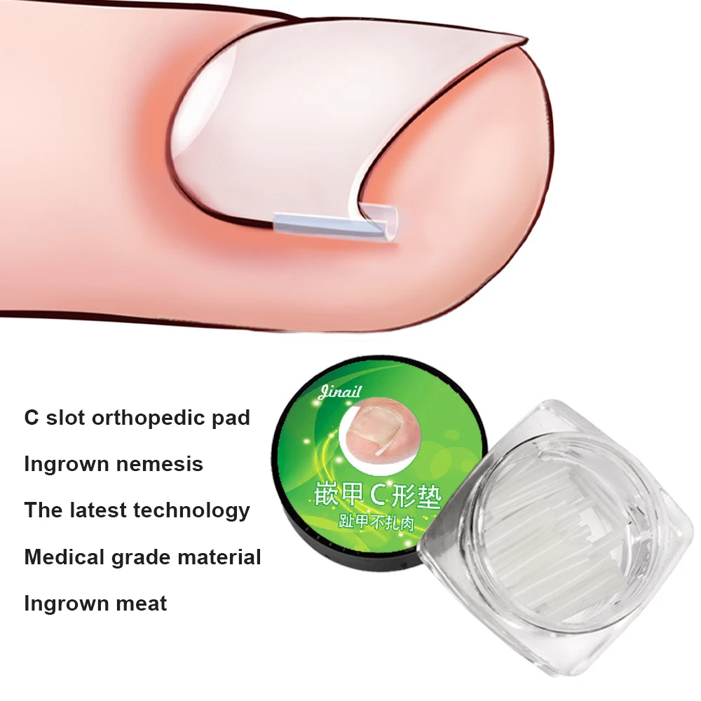 Ingrown Corrector Nail Patch, Correção Tube Pad, Endireitamento De Unhas E Corretores, Cuidados Com Os Pés